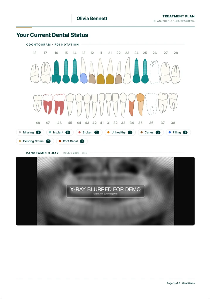 Dental tedavi planı örnek çıktı
